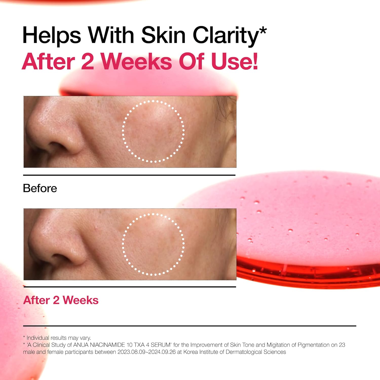 Anua Ultimate Glow Protection Duo, Zero-Cast Moisturizing Finish Sunscreen + Niacinamide 10 + TXA 4 Serum, SPF 50,No White Cast, Facial Serum for face, Korean skincare Set